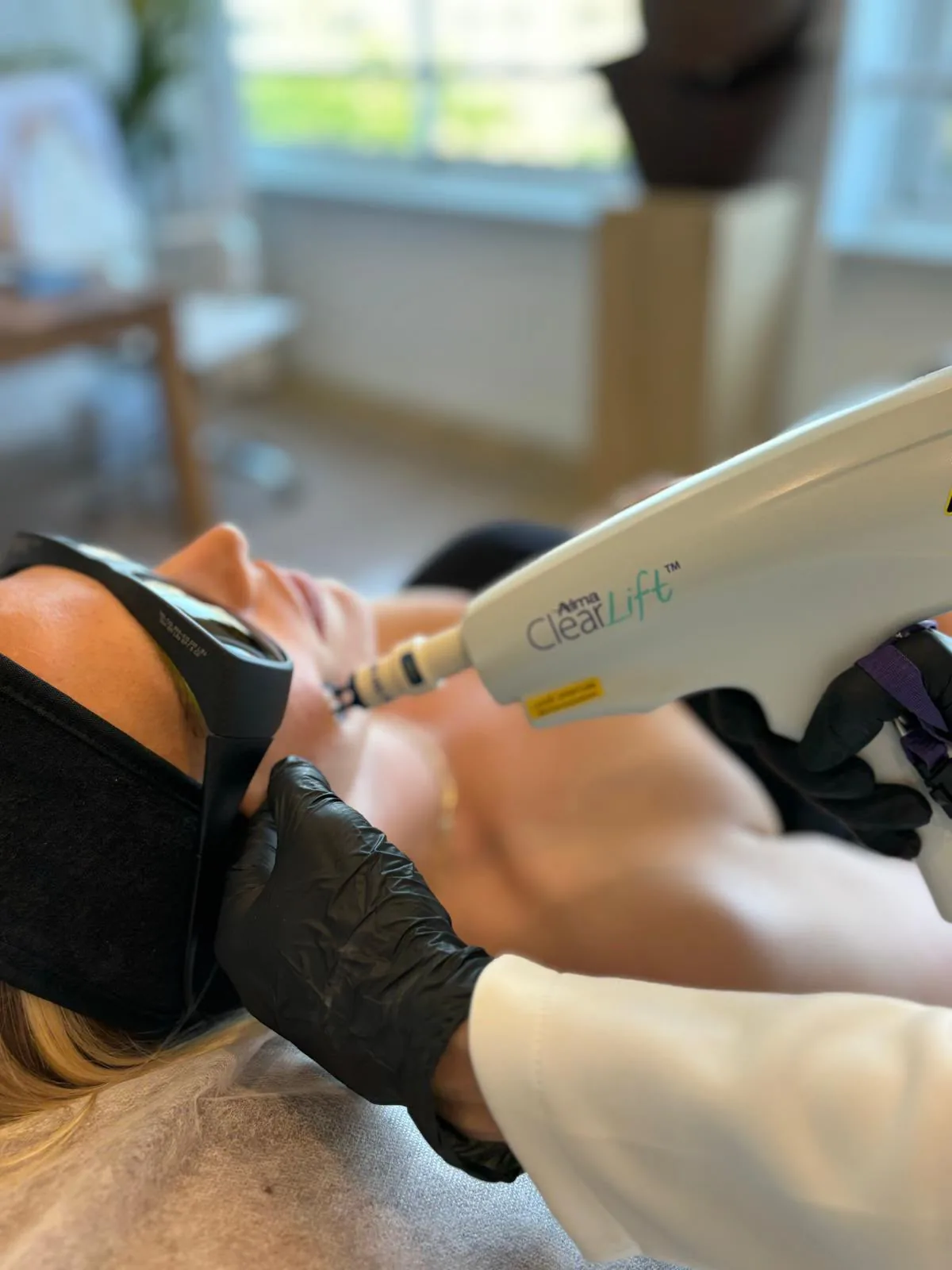Cabezal ClearLift apoyado en el mentón de una paciente tumbada con gafas de protección láser